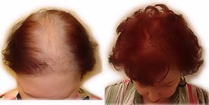 Light Medium Brown