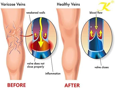 20-30mmhg Black Sleeve