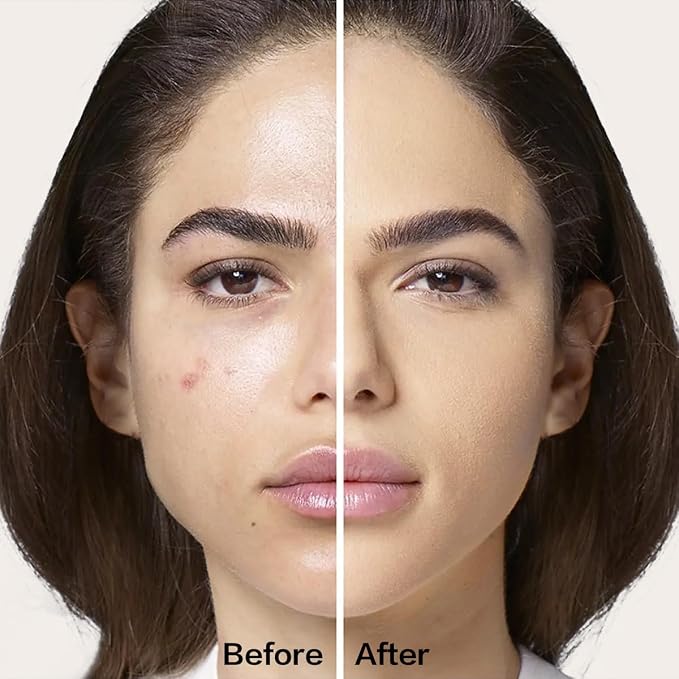 P01 for Dry Skin