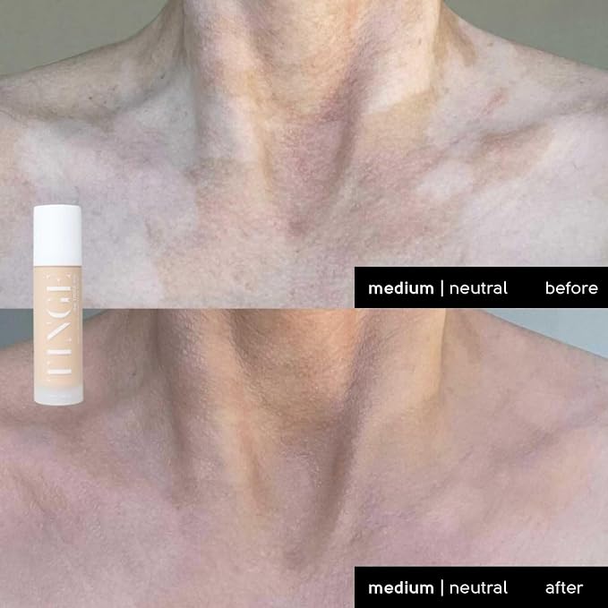 medium neutral