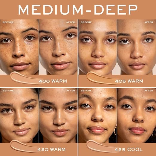 400W: For medium skin with warm/yellow undertones
