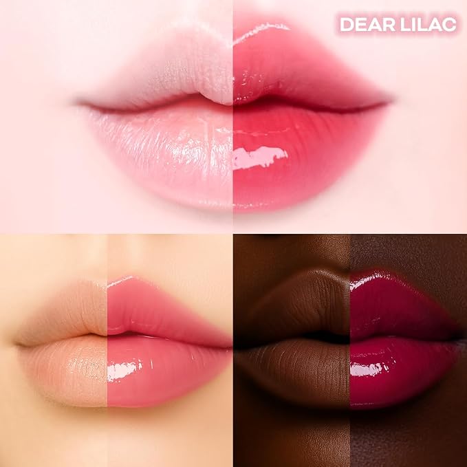 05. Dear Lilac