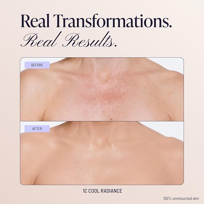 1C Cool Radiance
