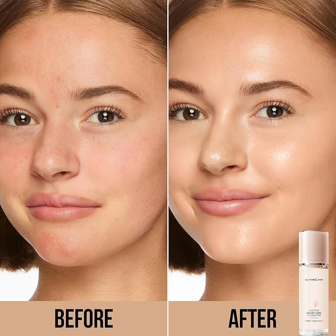 M01 for Dry Skin