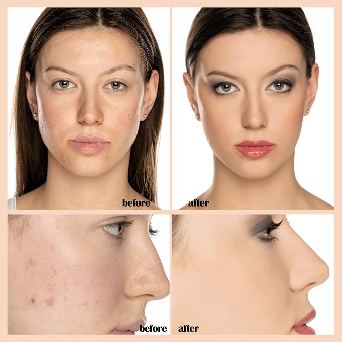 #102 Nude