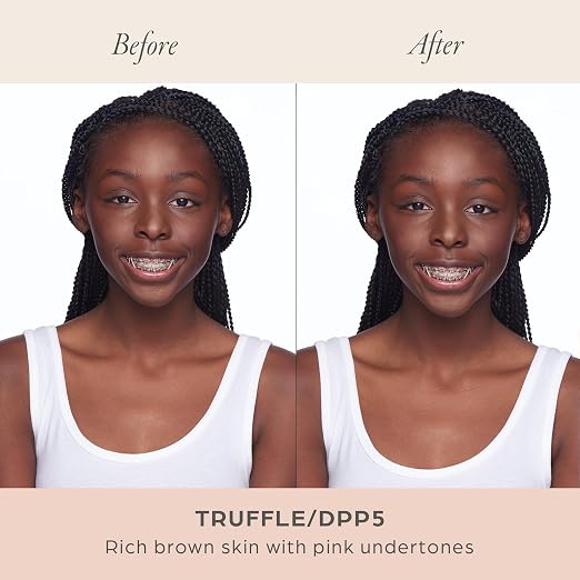 DPP5/Truffle