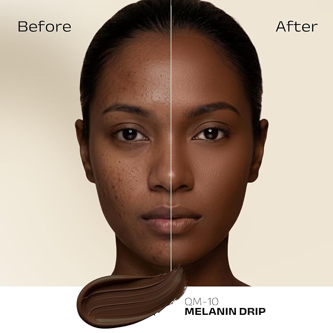 QM10- Melanin Drip