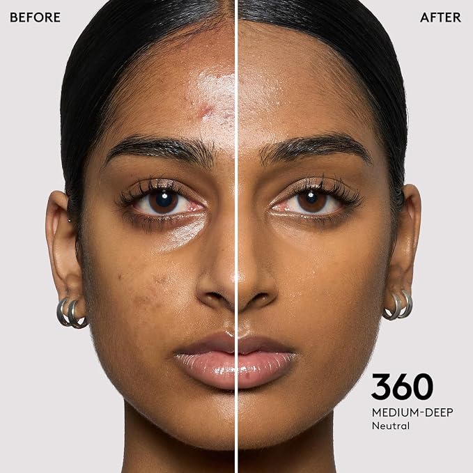 360 – neutral