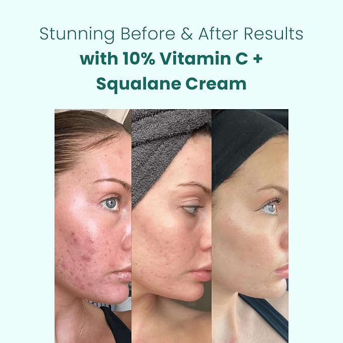 Vitamin C 10% x3