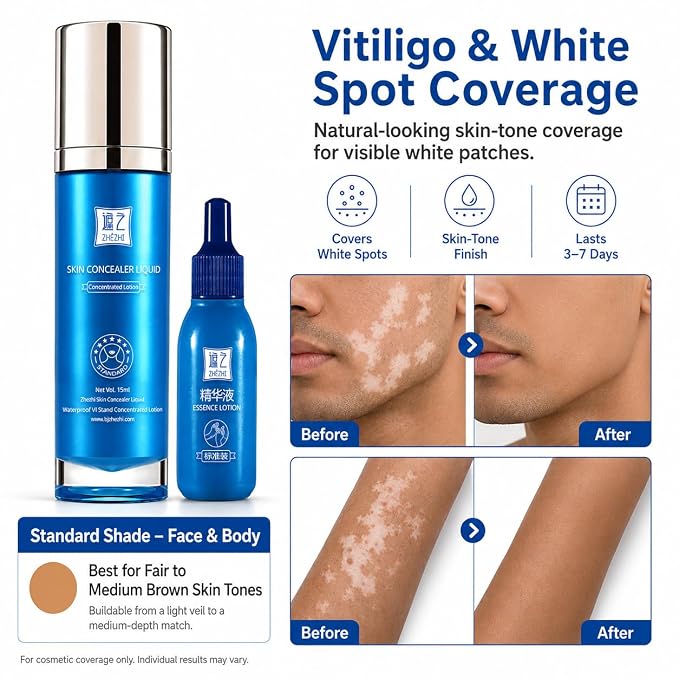 Light to Medium Skin Tone