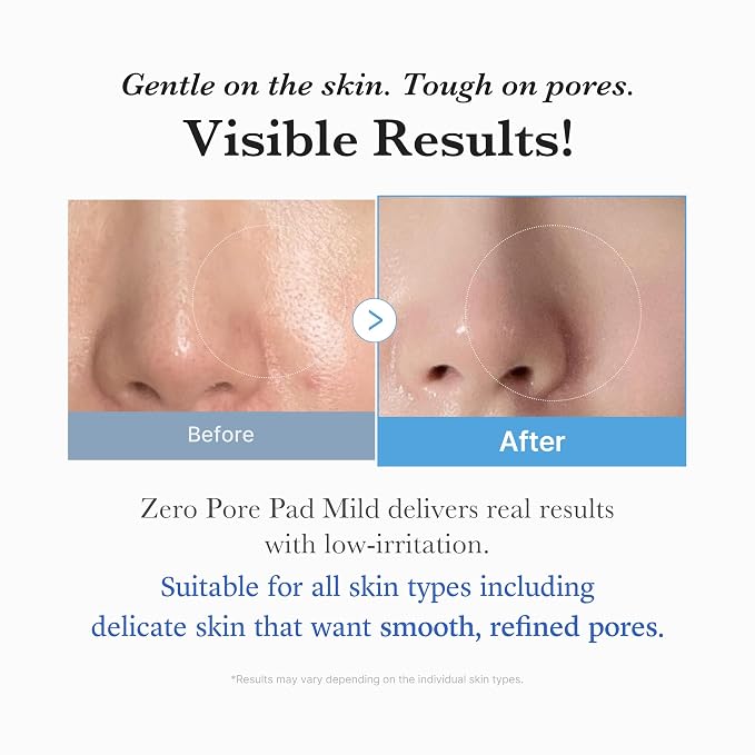 Mild Pads