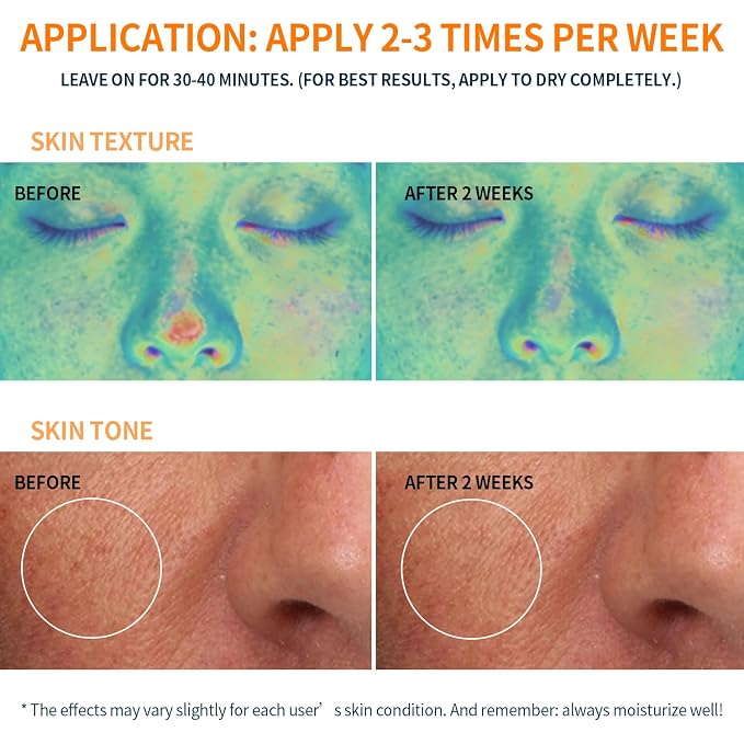 Anti Aging Mask