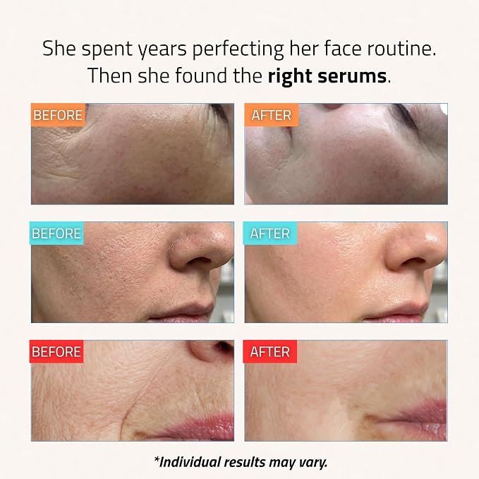 3-pack Retinol, HA, Vit C Pack