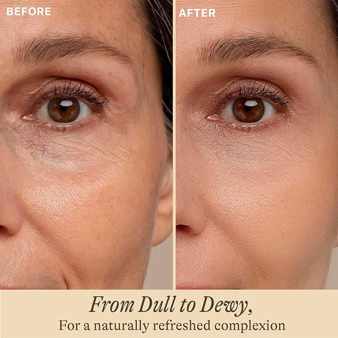 Hyaluronic Acid
