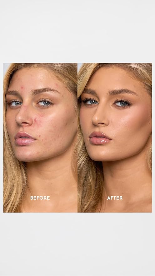 4L - Light with Neutral Undertones