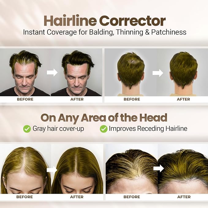 Medium Blonde