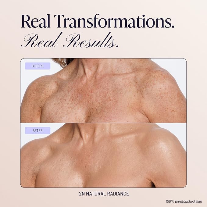 2N Natural Radiance