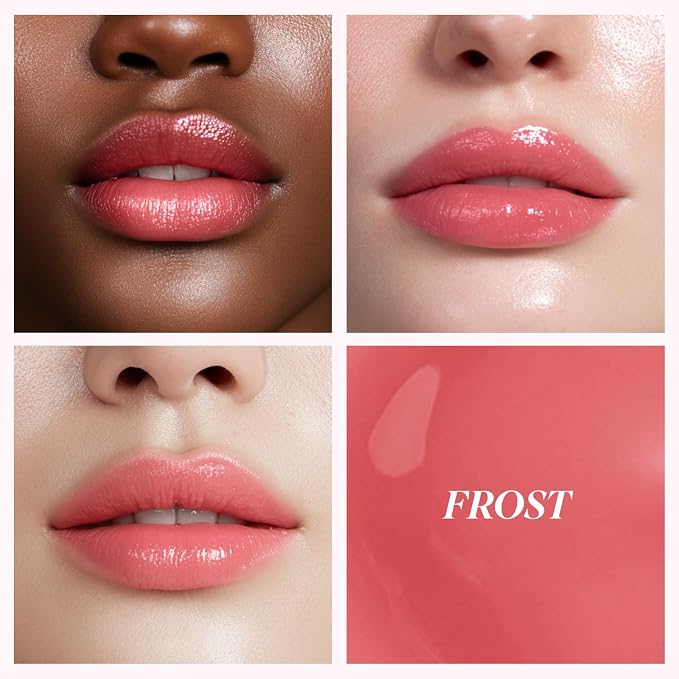 FROST