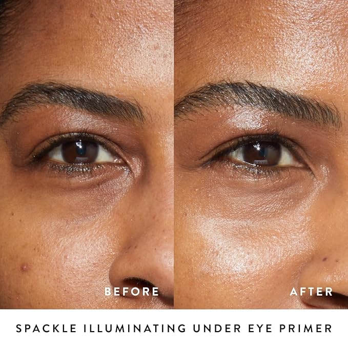 Eye Spackle