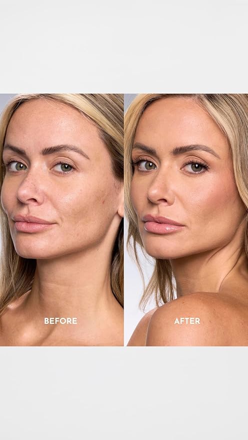 5L - Light with Warm Golden Undertones