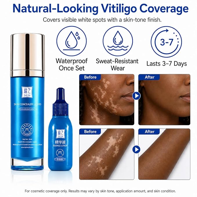 Brown to Deep Skin Tone