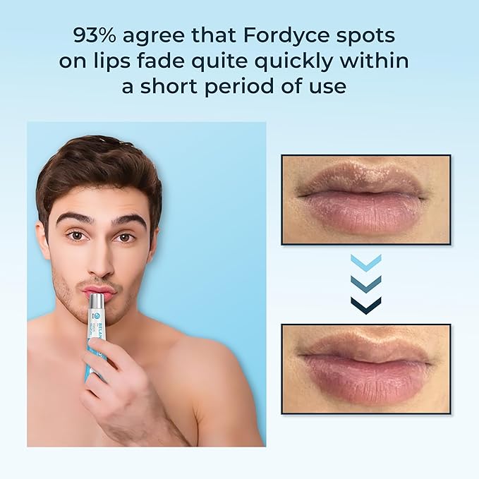 C. 2Fordyce + 2Dark