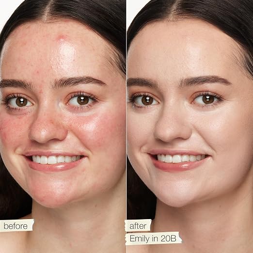20B light (light skin with cool, pink undertones)