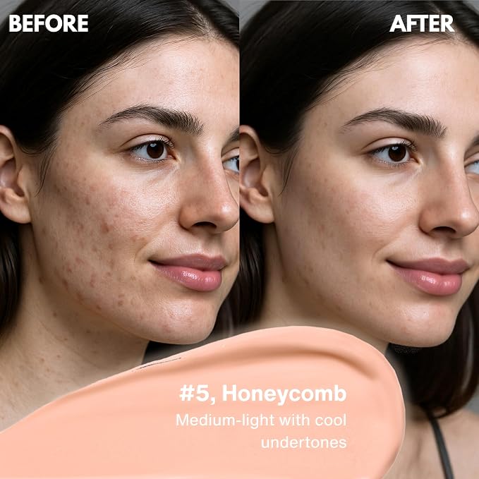 #5, Honeycomb