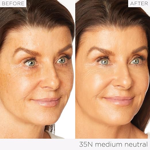35N medium neutral
