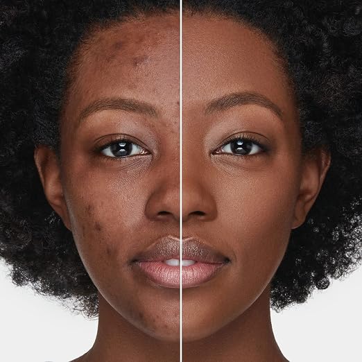 37N: Light to Medium skin with Neutral undertones