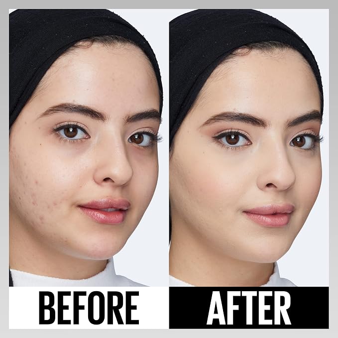 SS CONCEALER 10