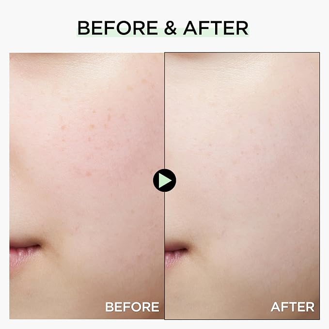 Tone Correcting