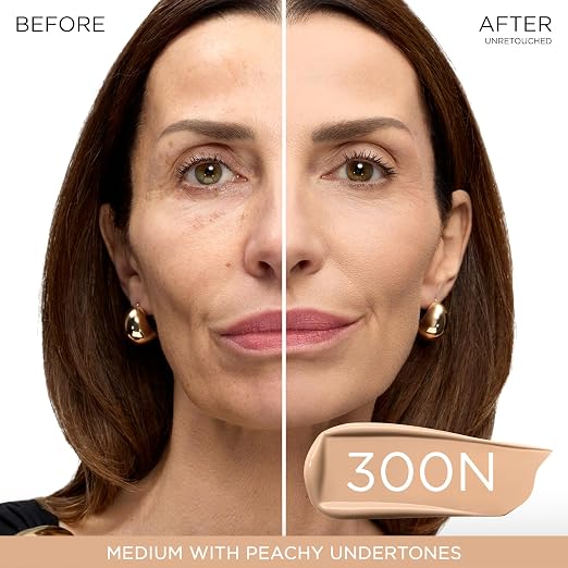 300N: Medium with Peachy Undertones