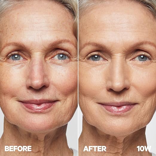 10W - Light Medium with Warm Undertones
