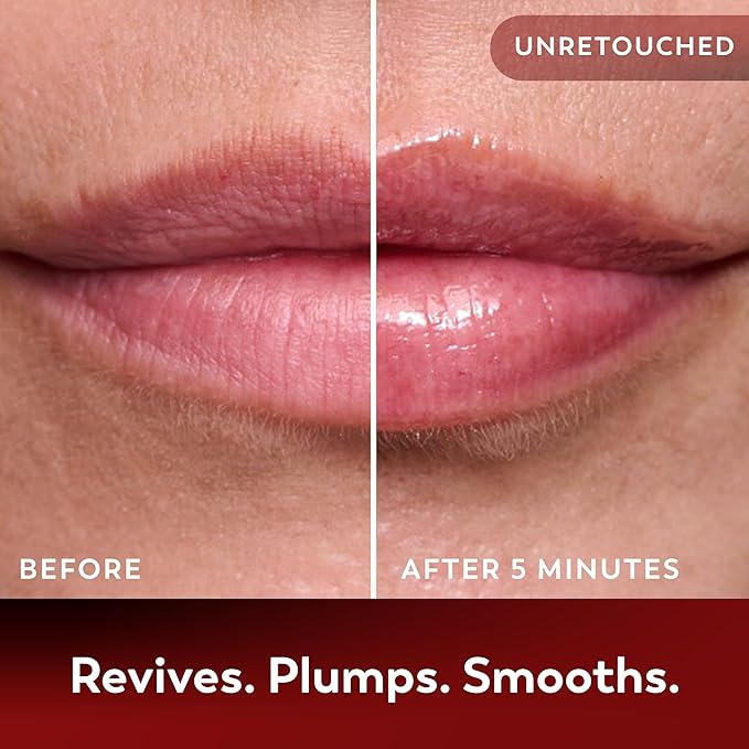 Lip Balm Treatment