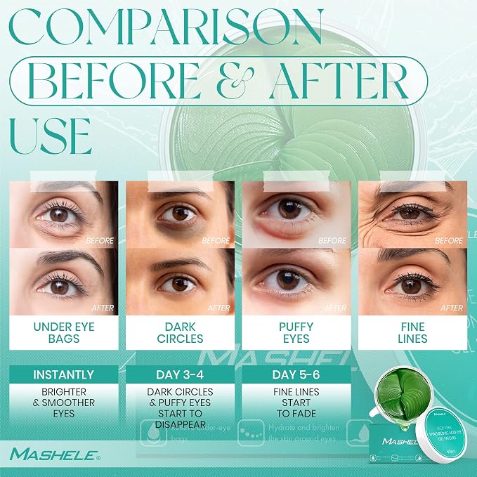 Aloe Hyaluronic