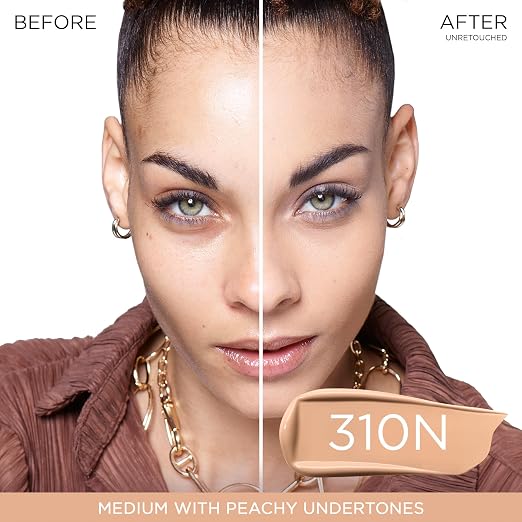 310N: Medium with Peachy Undertones