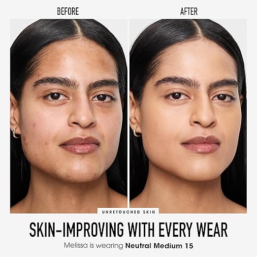 15 Neutral Medium
