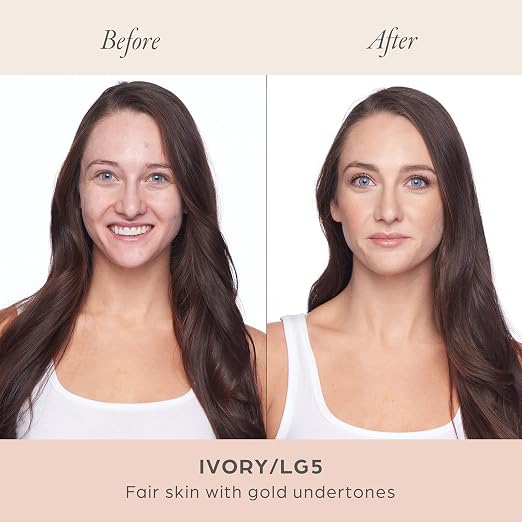 LG5/Ivory