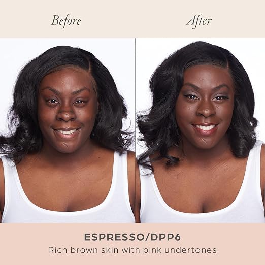 DPP6/Expresso