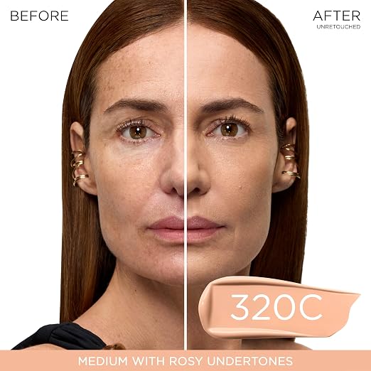 320C: Medium with Rosy Undertones