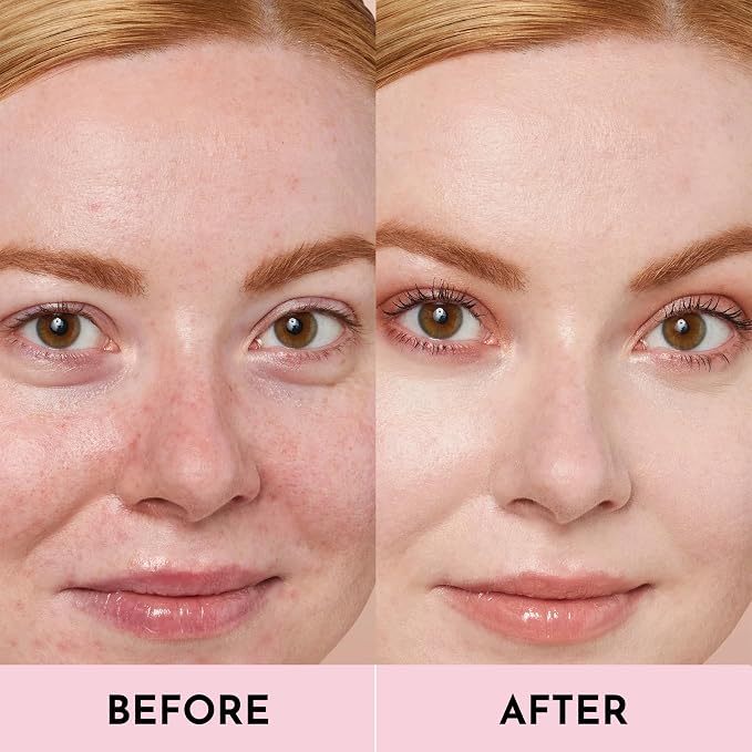 Petal: very fair with pink undertones
