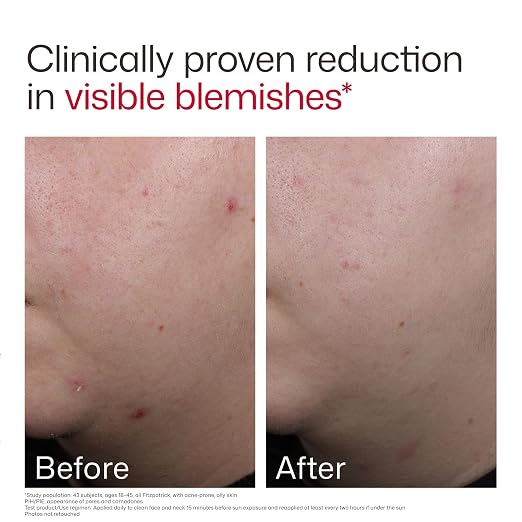 09 - New Blemish Prone (0.5 oz)