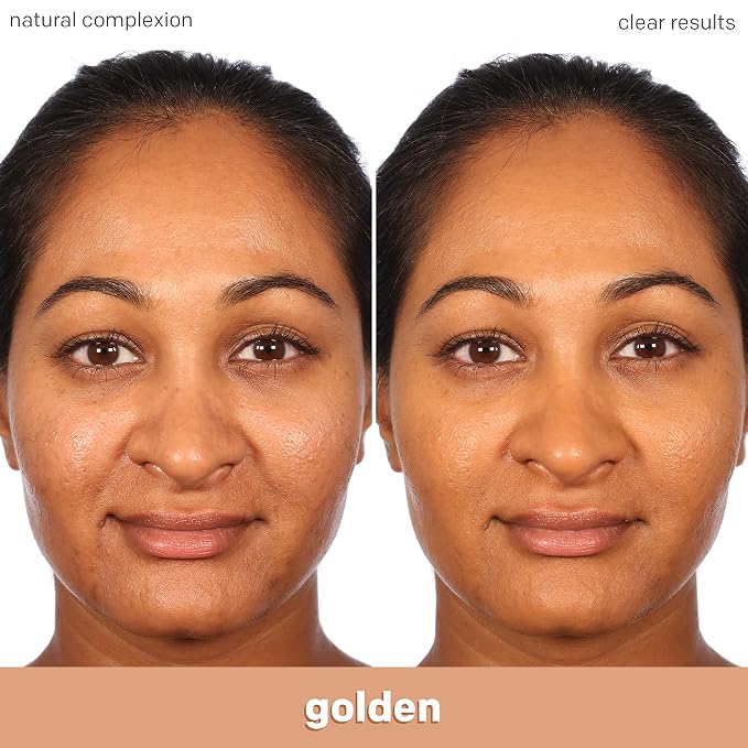 710 - Medium with Neutral Undertone
