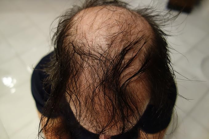 Dark Salt & Pepper