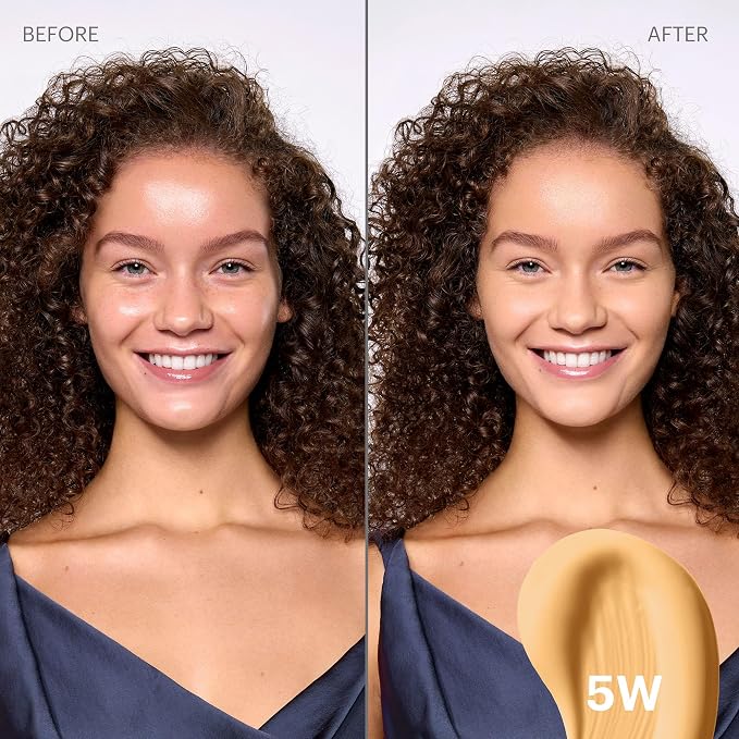 5W