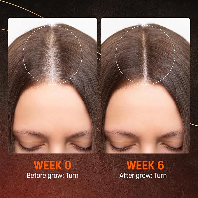 A. 1 Serum